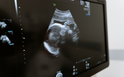 Cuatro nuevos acompañamientos reflejan la labor del Proyecto Raquel